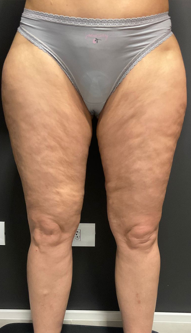 Morpheus-3-1 Morpheus-3-1